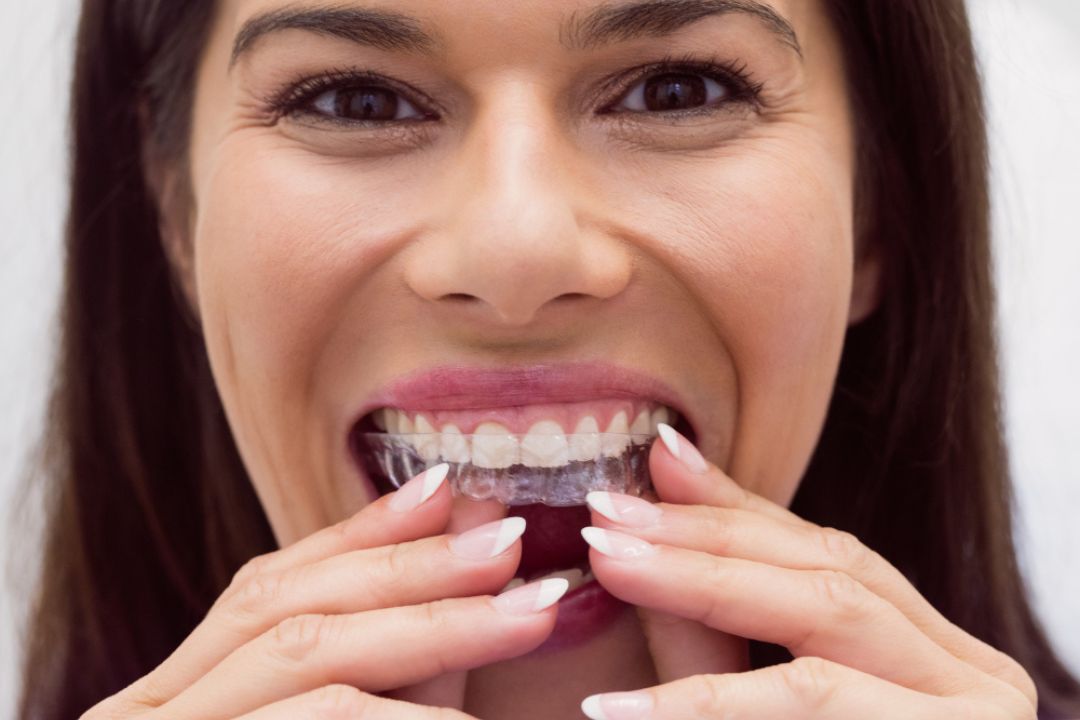 “are clear aligners safe for your teeth and gums
